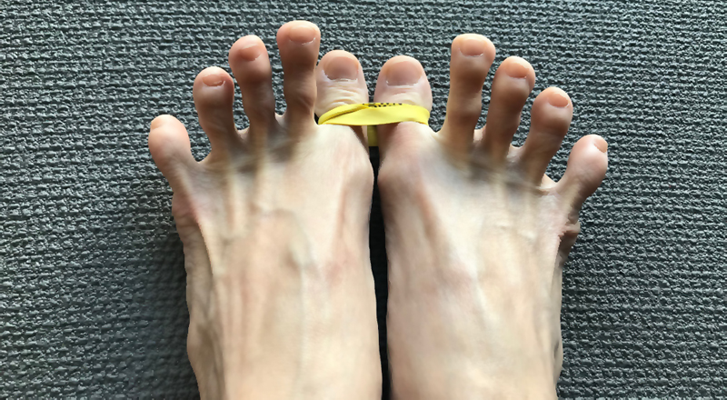 外反母趾に効果